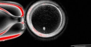 Pela primeira vez, cientistas criam óvulos fecundáveis a partir de células da pele humana