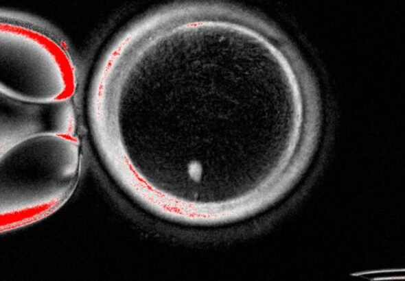 Pela primeira vez, cientistas criam óvulos fecundáveis a partir de células da pele humana