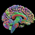 A "adolescência" do cérebro vai até os 32 anos: novo estudo de Cambridge mostra os 5 estágios da vida cerebral | National Geographic
